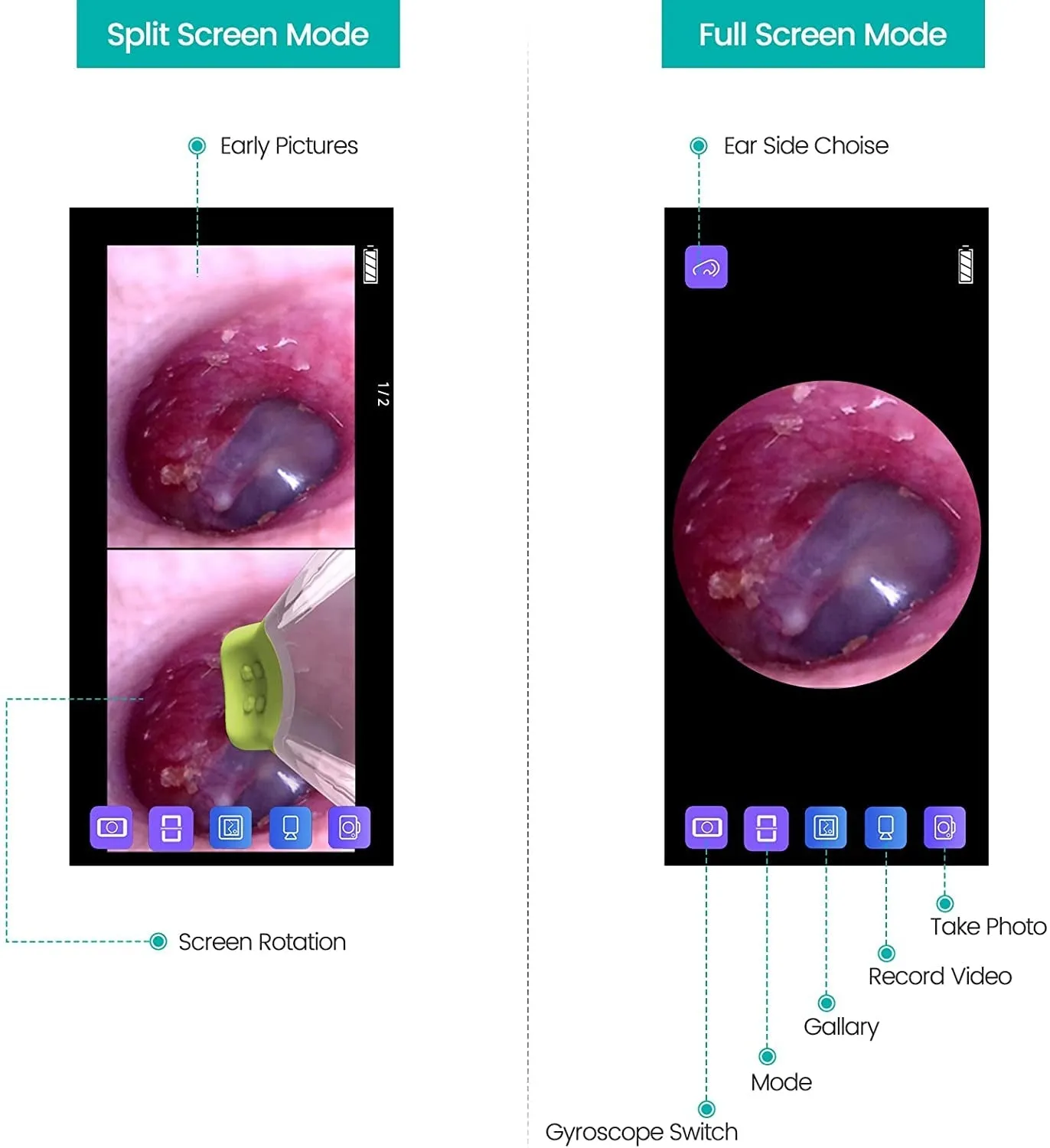 Ear Camera Endoscope 3.9mm - Digital Ear Inspector Compatible with Android and iPhone